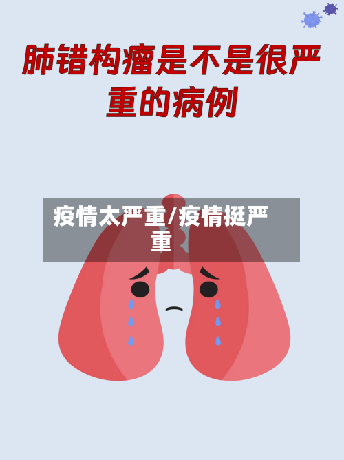 疫情太严重/疫情挺严重-第1张图片